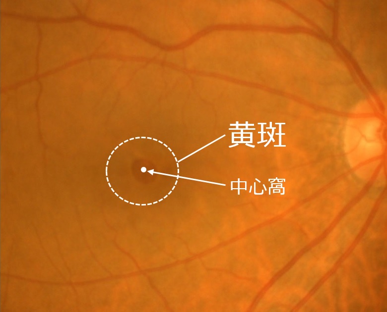 Photo_黄斑疾患総合ケアユニット_No.1